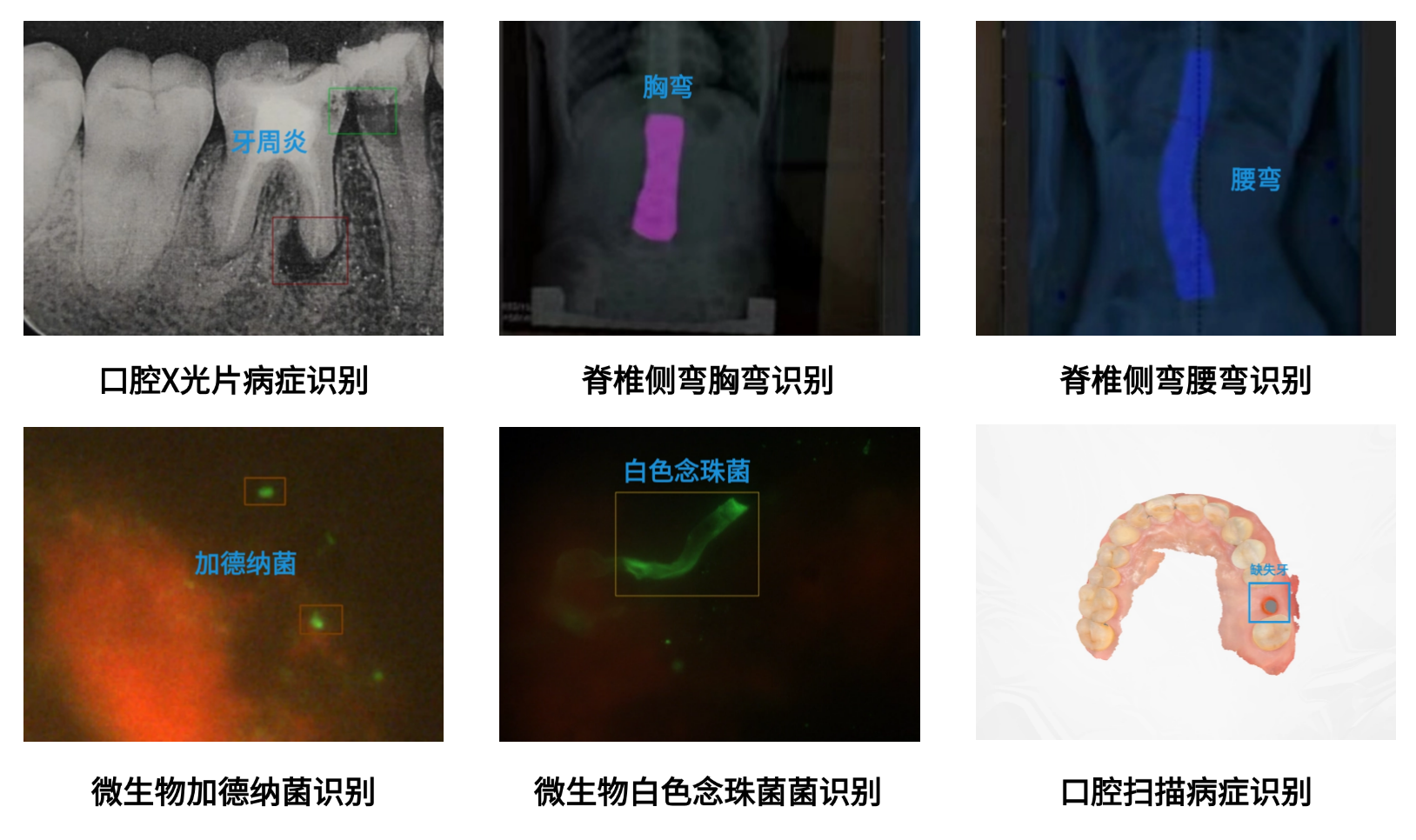 医疗领域 AI 算法定制示意